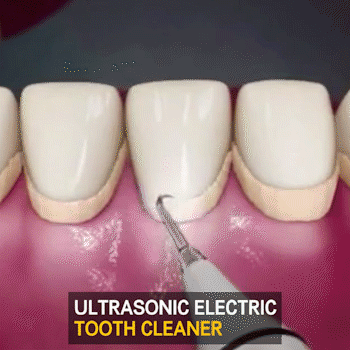 Electric Dental Calculus Remover